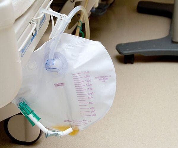 Urinary Catheter, a Foley Bag